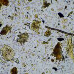 soil microorganisms close up under the microscope.